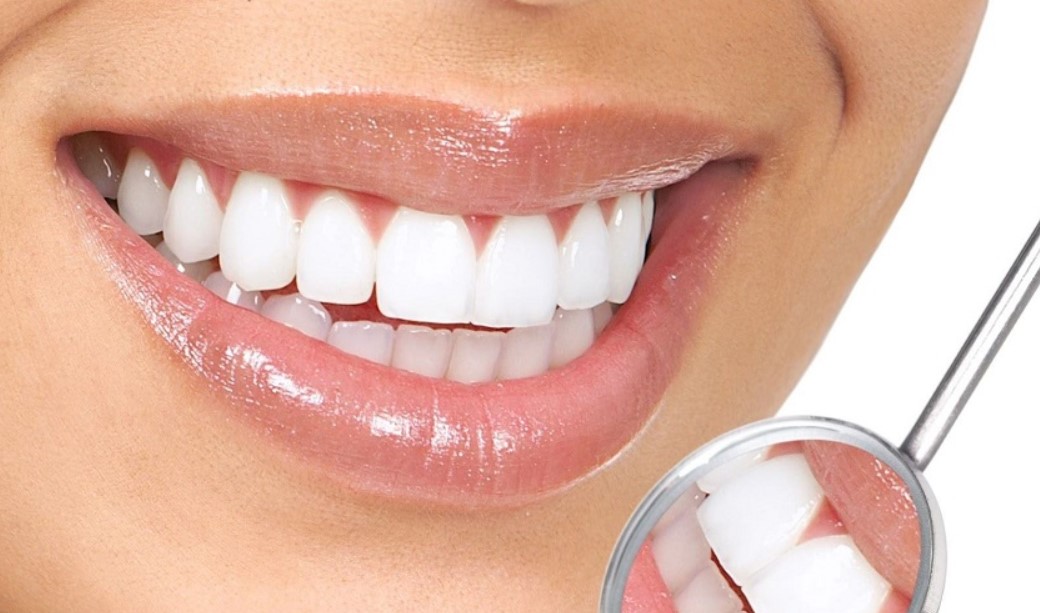Khắc phục khuyết điểm của răng
