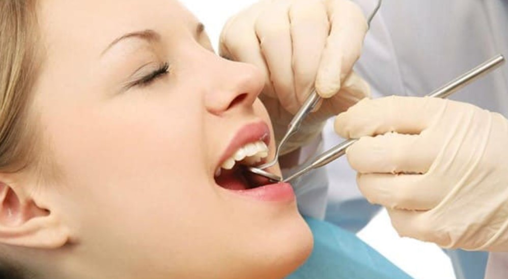Quy trình phủ răng sứ chuẩn y khoa tại Platinum Dental