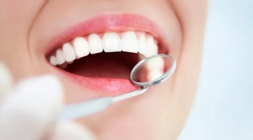 quy trình bọc răng sứ