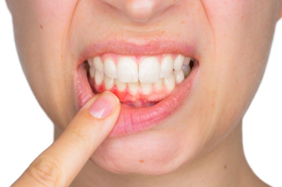 Chế độ ăn uống không phù hợp
