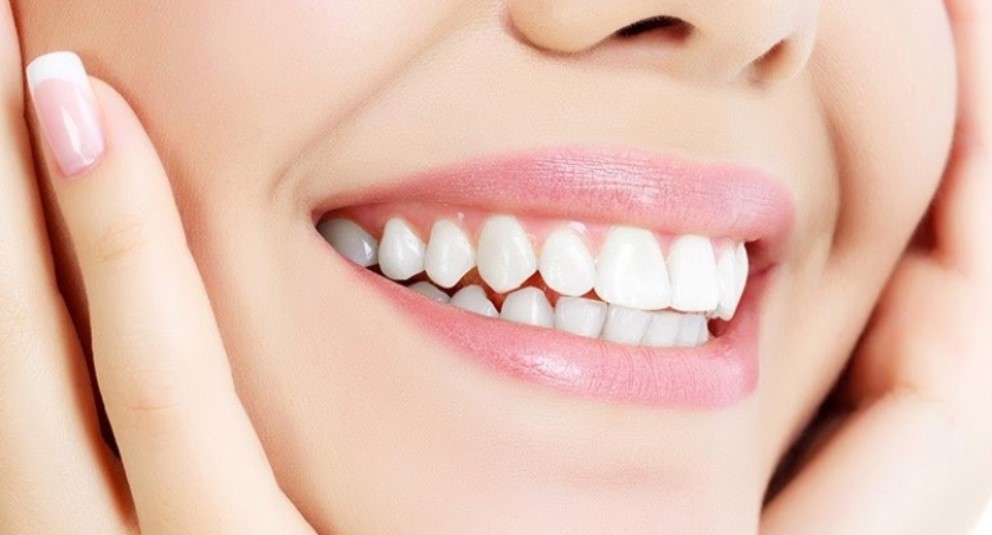Đối tượng bọc răng sứ Diamond là ai