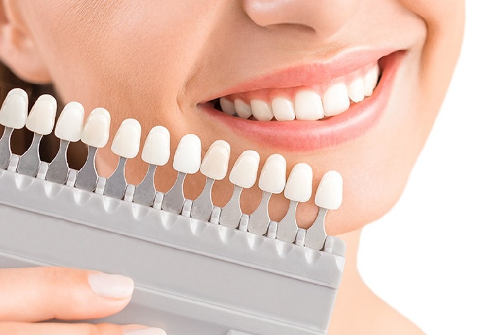 Platinum Dental tự hào là địa chỉ làm răng sứ Lisi uy tín, chất lượng hàng đầu trên thị trường hiện nay