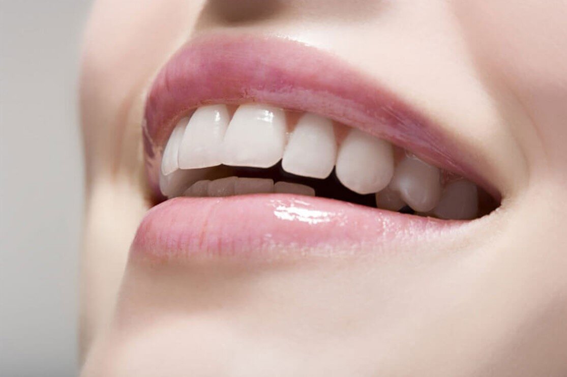 Cải thiện nụ cười rạng rỡ