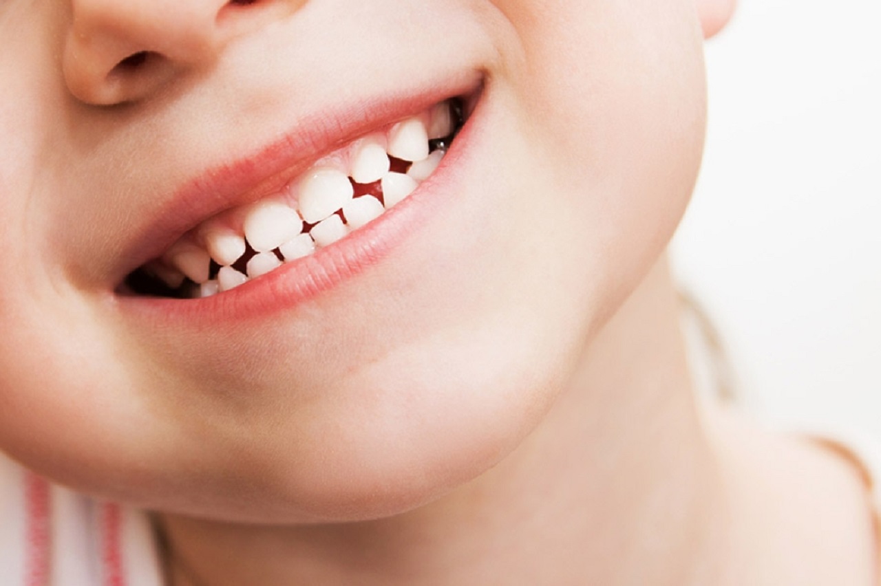 Nhổ răng sữa không ảnh hưởng đến răng hàm