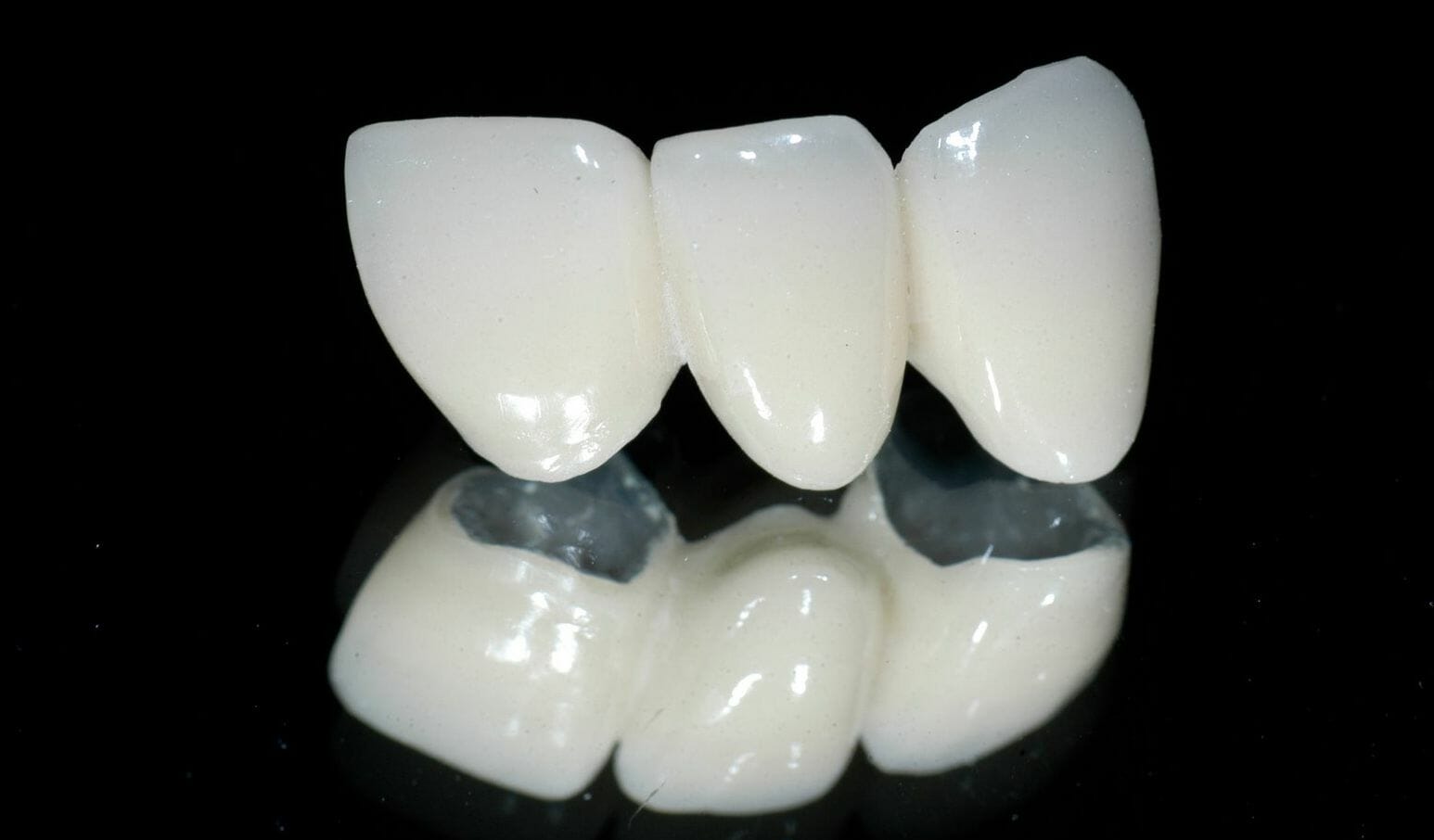 Răng sứ Ceramill có xuất xứ tại Đức