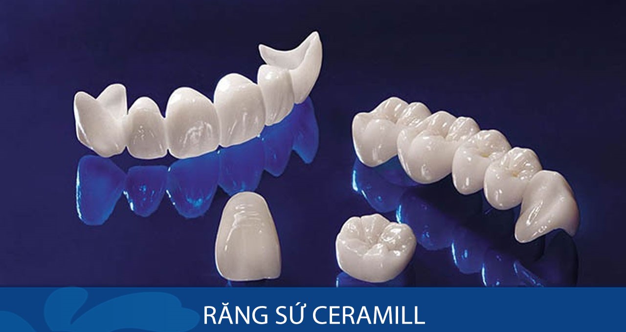 Răng toàn sứ Ceramill có 2 loại chính