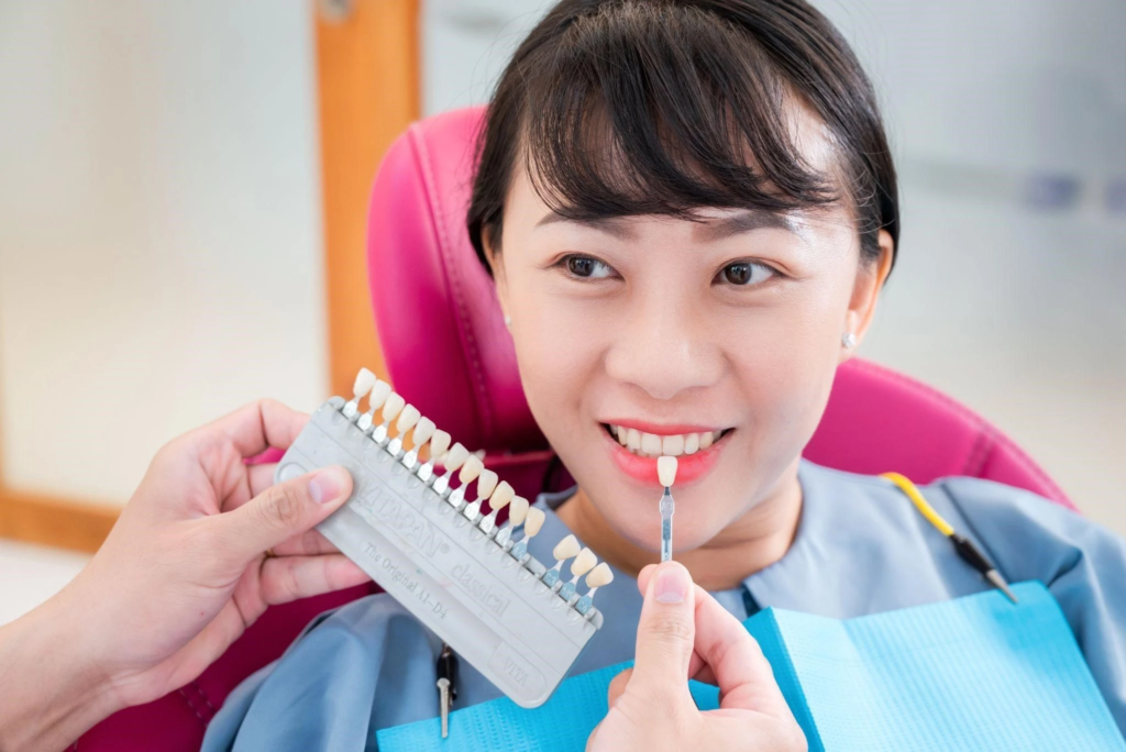 Bọc răng sứ có tẩy trắng được không?