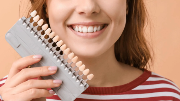 Răng sứ Orodent có hiệu ứng phát sáng
