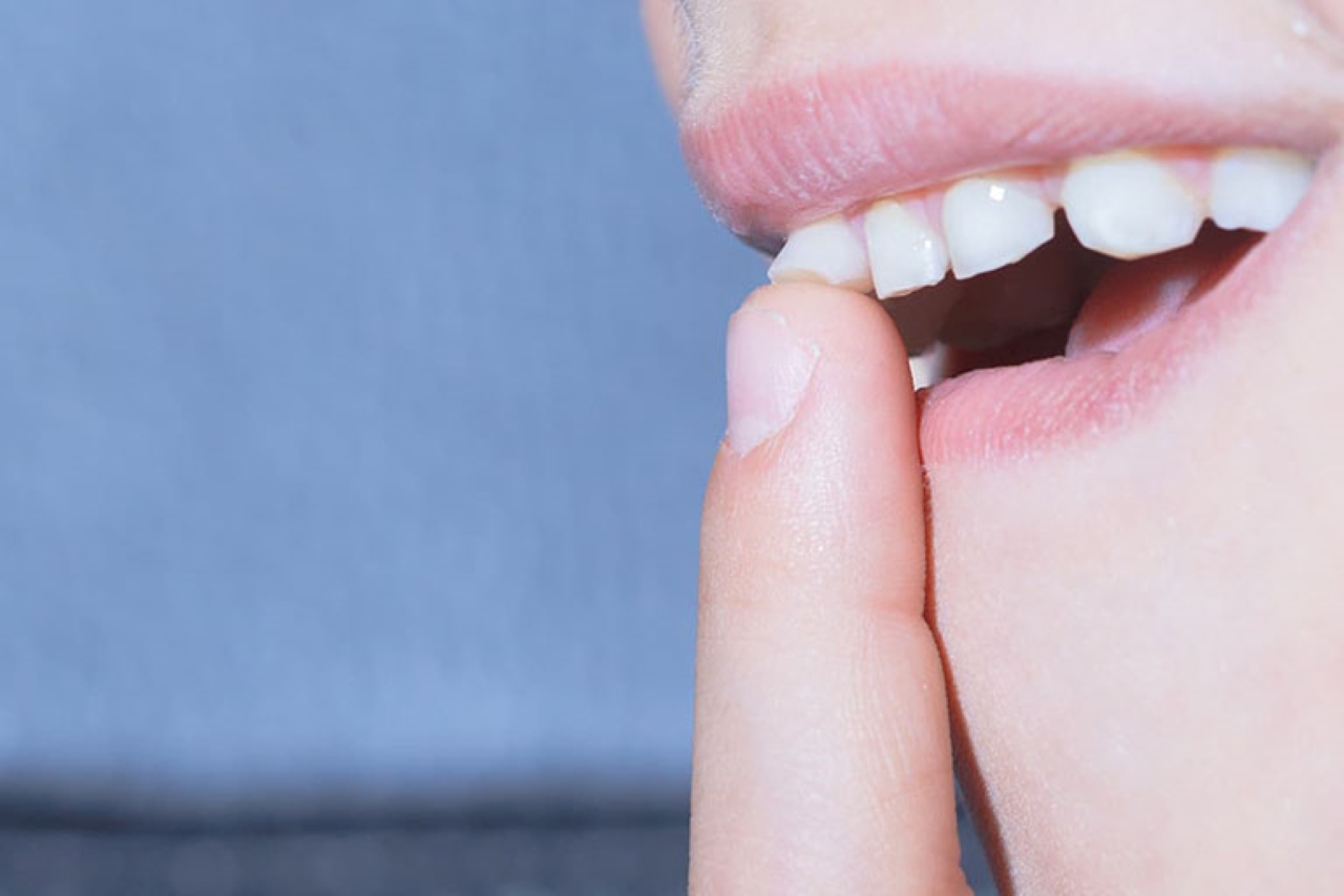Dùng lưỡi để đẩy răng sữa của trẻ lung lay