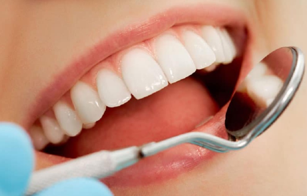Điều kiện cần thiết để bọc răng sứ trả góp