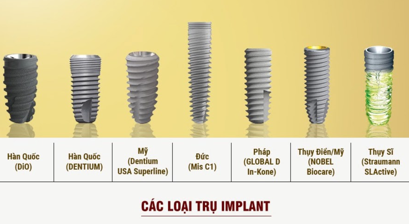 các loại trụ Implant