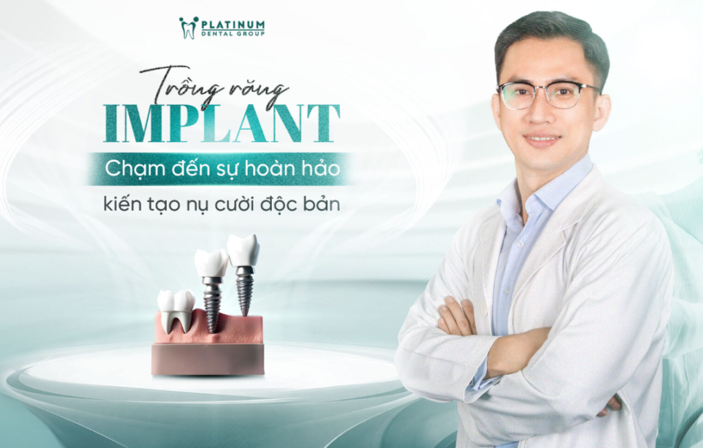 các loại trụ Implant