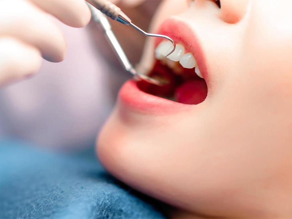 Điều trị nang chân răng ngay khi phát hiện