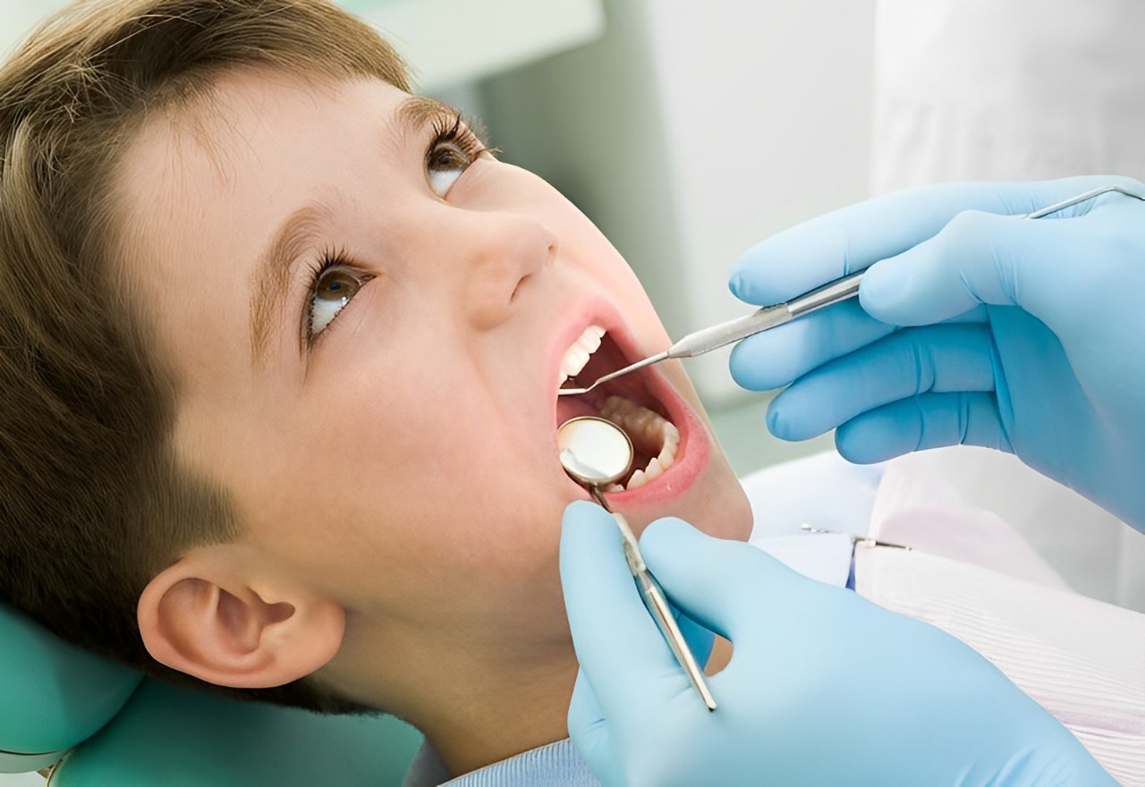 Điều trị sâu chân răng sớm để không gây biến chứng