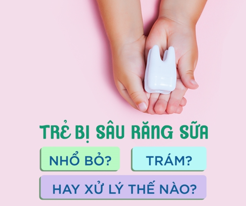 răng sữa bị sâu