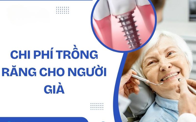chi-phi-trong-implant-cho-nguoi-gia