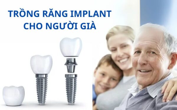 trong-rang-implant-cho-nguoi-gia