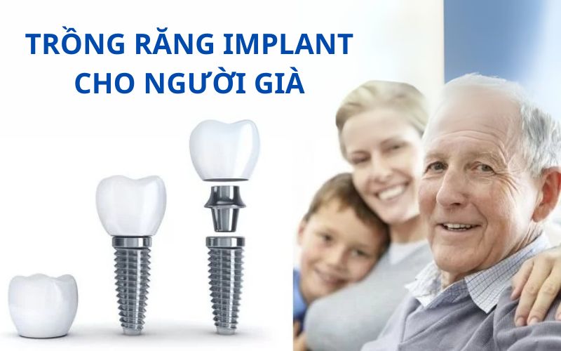 trong-rang-implant-cho-nguoi-gia