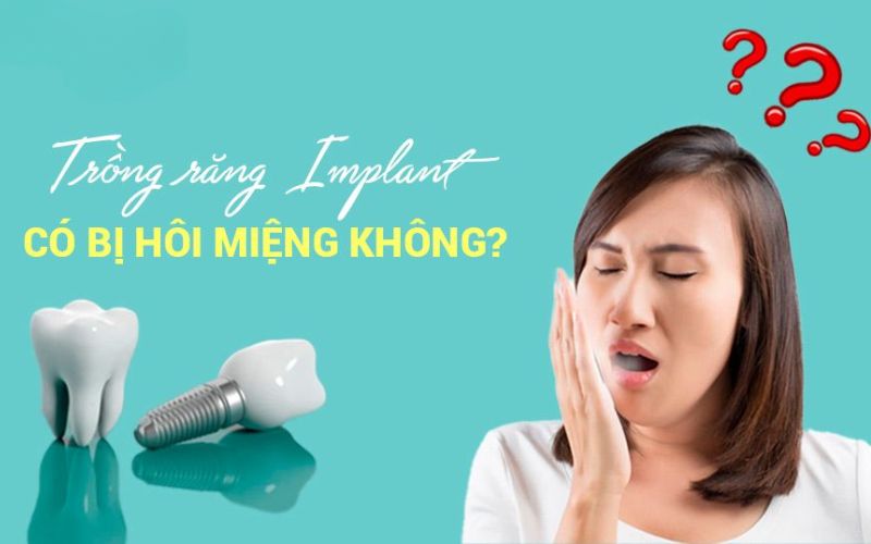 trong-rang-implant-co-bi-hoi-mieng-khong