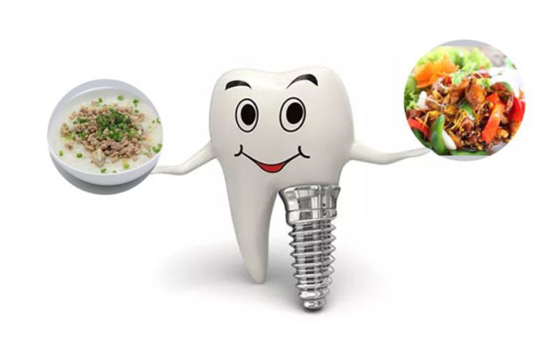 trong-rang-implant-co-bi-hoi-mieng-khong